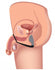 Explorer II Prostate Stimulator Plus Cock Ring Image 4