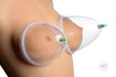 Breast Cupping System Image 3