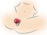 Bloomgasm Wild Rose 10X Silicone Clit Stimulator